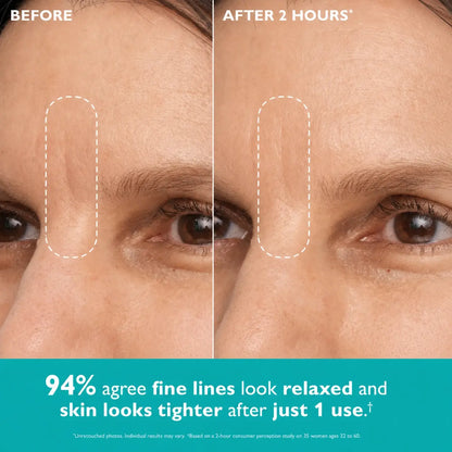 Aura Skin Care - Expression Lines Remover™