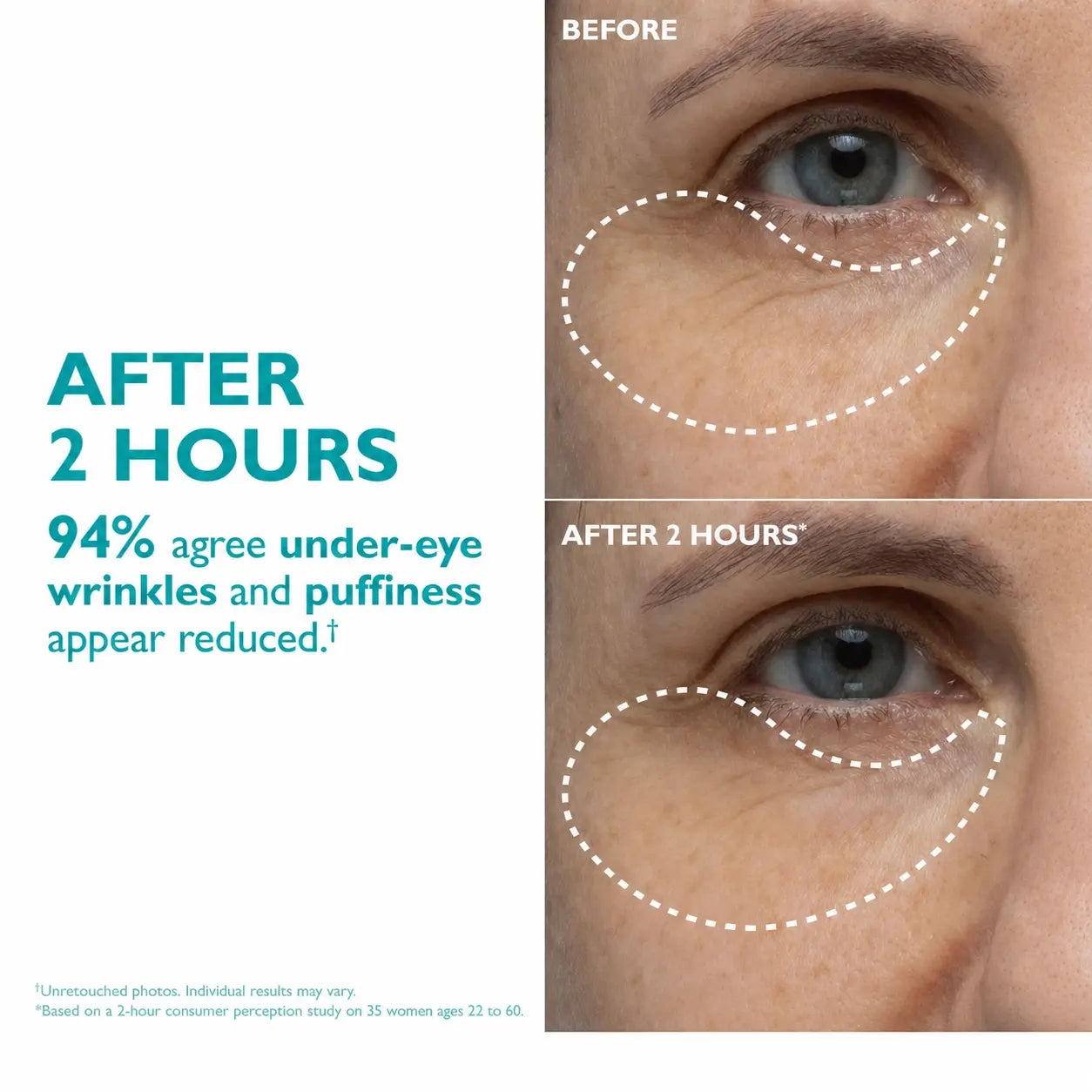 Aura Skin Care - Expression Lines Remover™