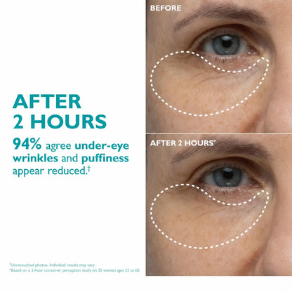 Aura Skin Care - Expression Lines Remover™