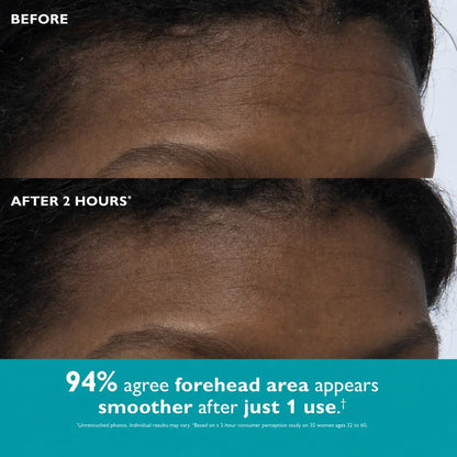 Aura Skin Care - Expression Lines Remover™